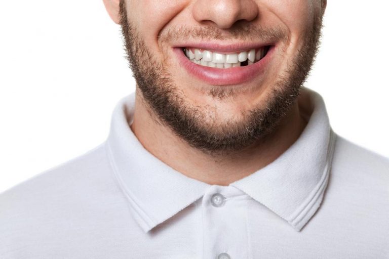 Missing Teeth Replacement Singapore