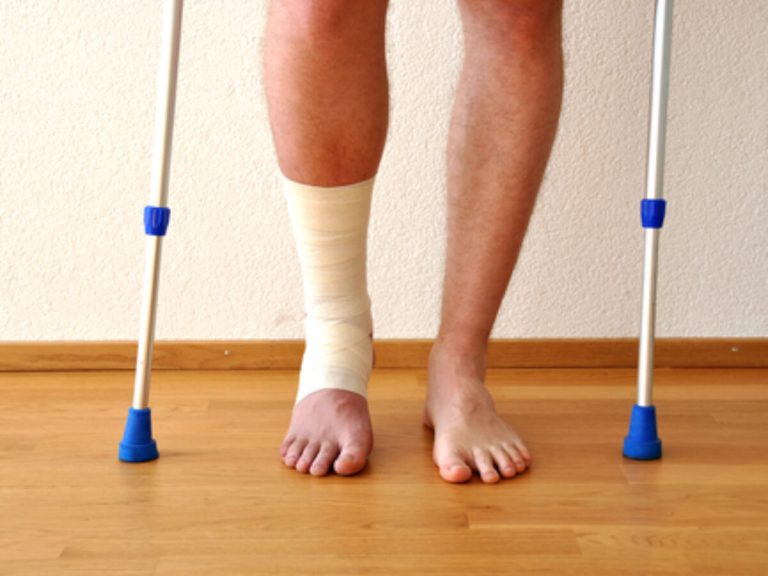 More about the Physiotherapy after ankle surgery