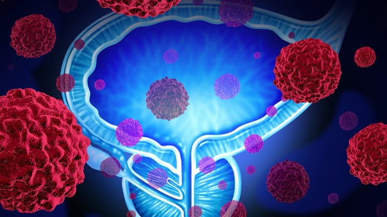 What should you Know Before Undergoing Cancer Treatment?