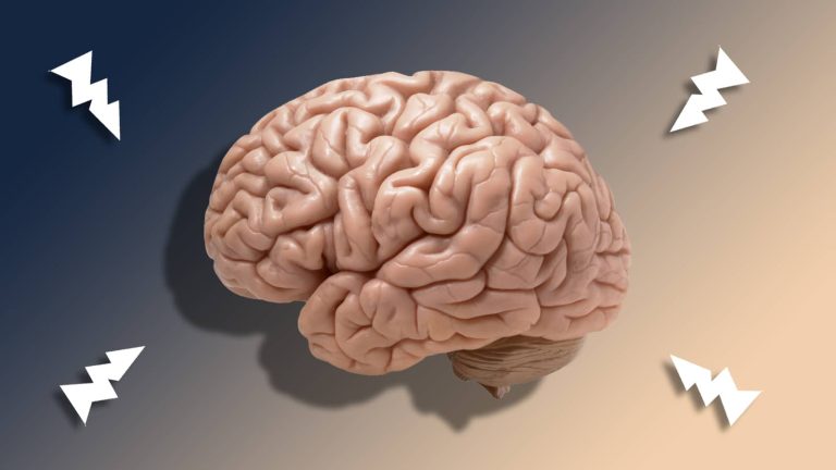 How to Choose the Best Nootropics