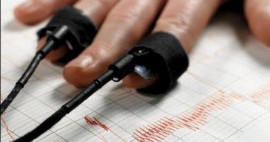 Lie Detector Tests in Legal Cases: How They Can Impact Your Trial